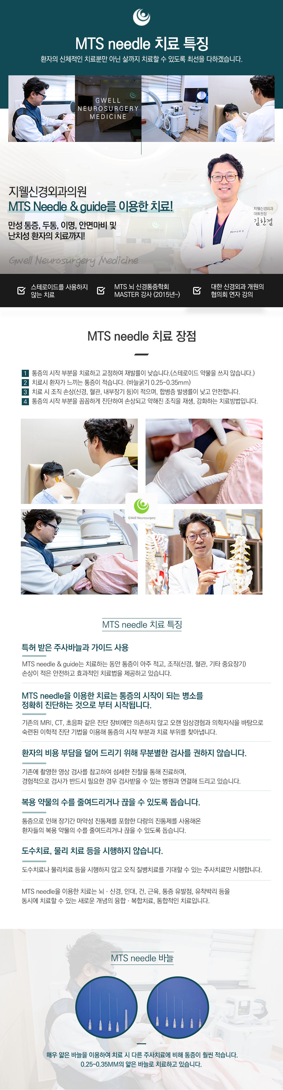 MTS needle 특징