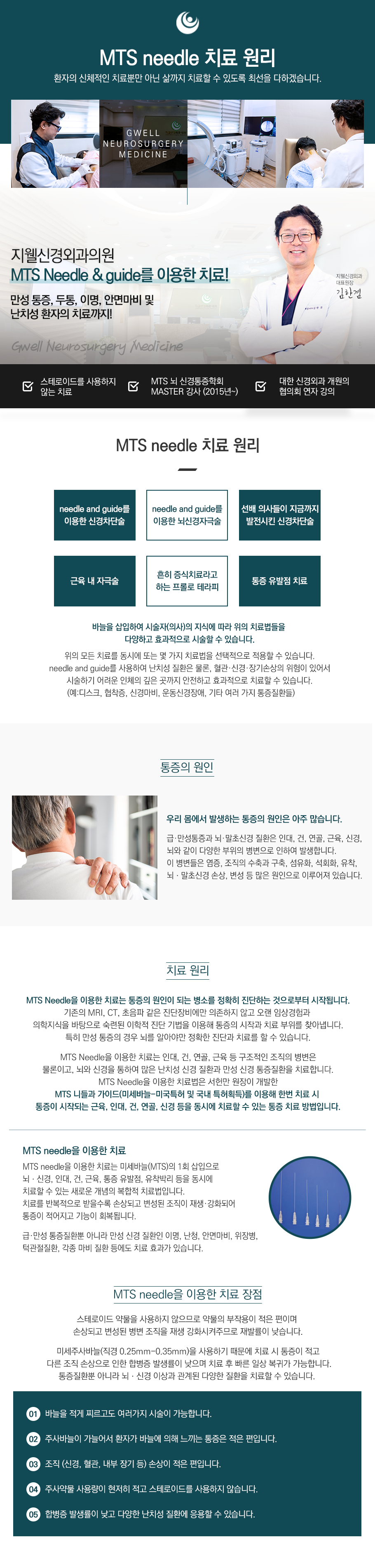 MTS needle 원리