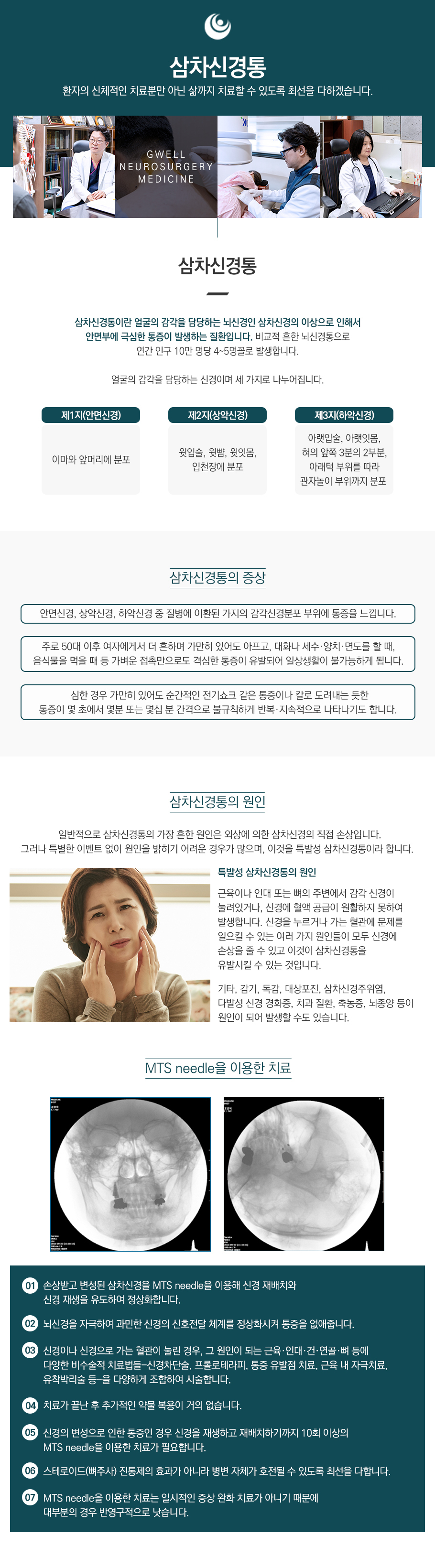 삼차신경통
