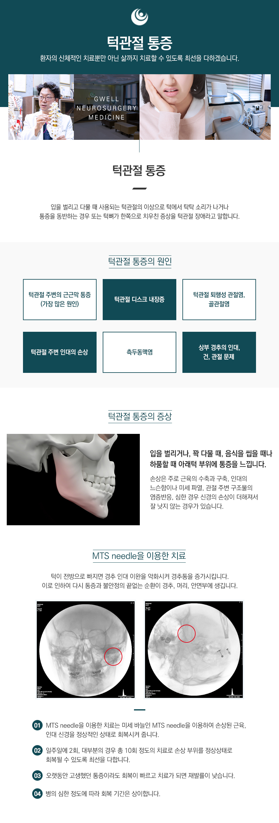 턱관절 통증