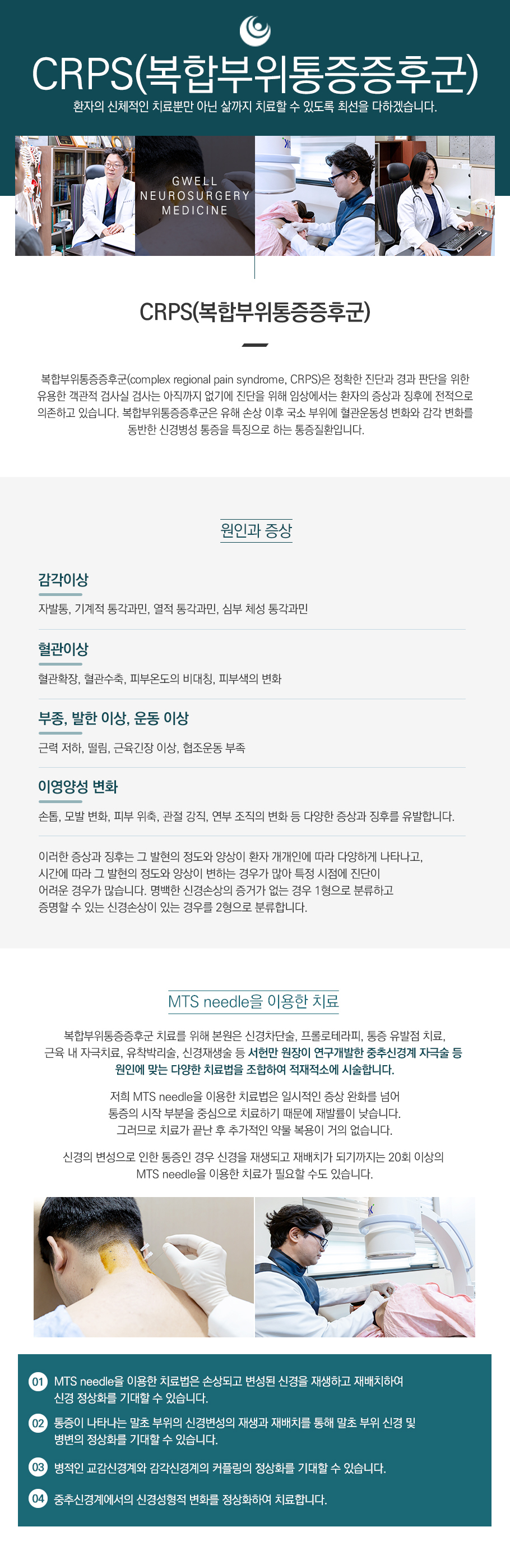CRPS 증후군